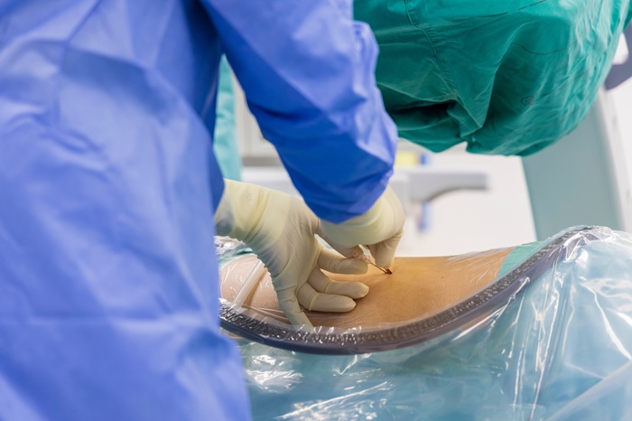 Procedures Offered by Our MSK Pain Management Clinic