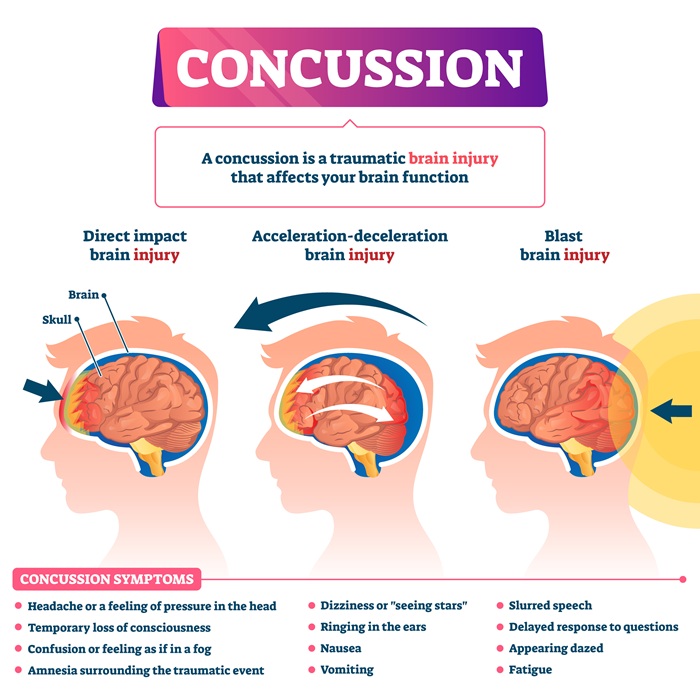 Concussion Symptoms